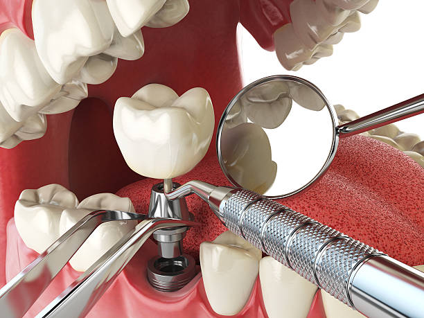 Best Emergency Treatment for Oral Infections in Jefferson City, TN